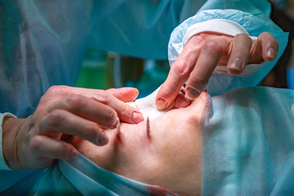 Rinoplastia: Chirurgia Nasului